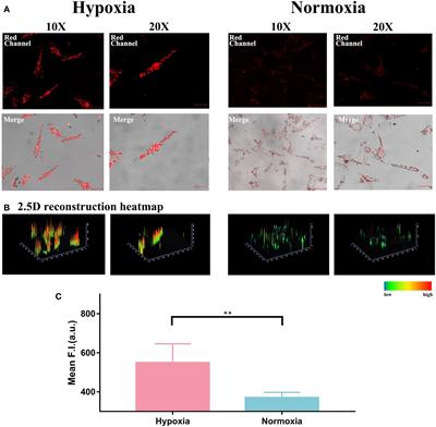 Real-time optical imaging of the hypoxic status in hemangioma endothelial cells during propranolol therapy